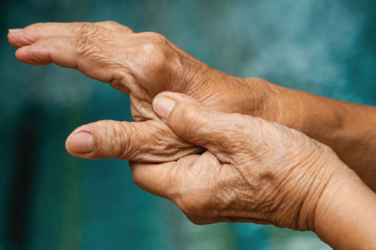 Oceanside Chiropractic blog "What is Arthritis?